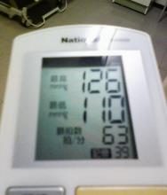 血圧計異常